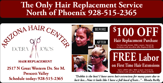Coupon Offer: $100 OFF Hair Replacement Purchase