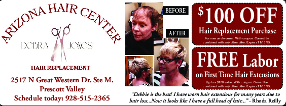 Coupon Offer: $100 OFF Hair Replacement Purchase