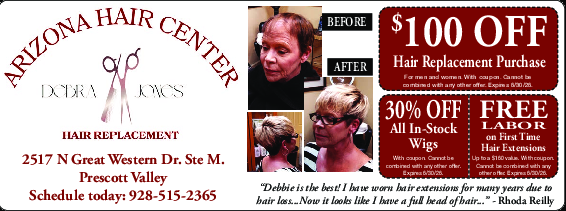 Coupon Offer: $100 OFF Hair Replacement Purchase
